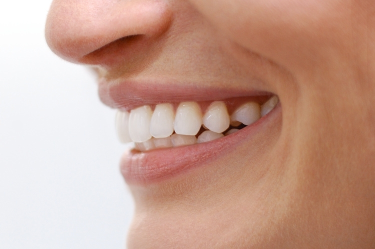 Veneers for a bright smile