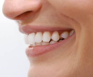 Veneers for a bright smile