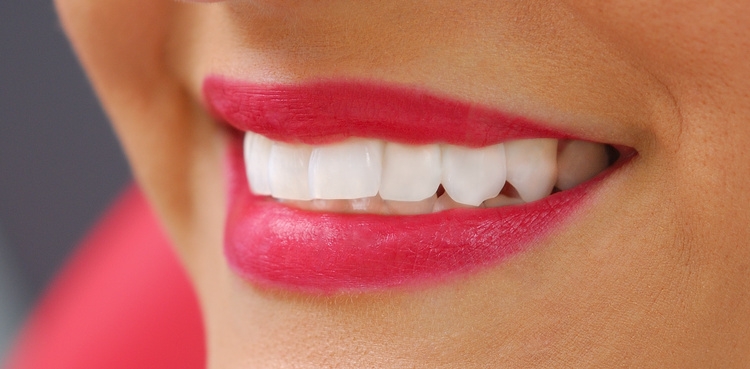 Tips for safety teeth whitening