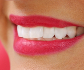 Tips for safety teeth whitening